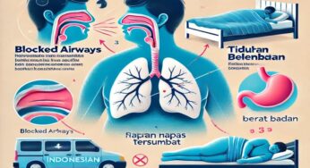 Bebas Ngorok Saat Tidur! Ini Tips Lengkap Mengatasi Mendengkur