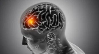 Makanan yang Efektif Cegah Stroke Sejak Dini