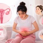 Sering Haid Tidak Teratur? Bisa Jadi Ini Salah Satu Tanda PCOS
